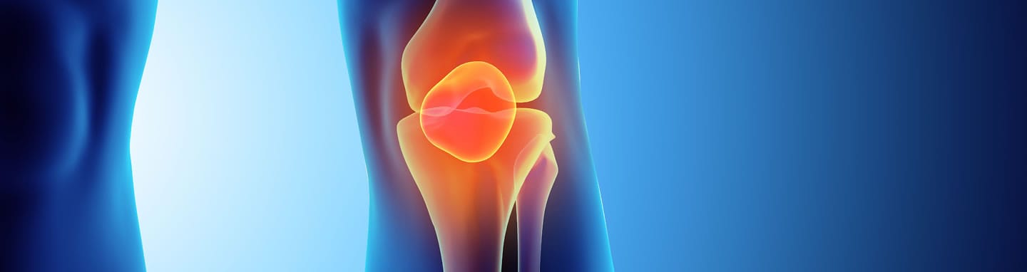 GAE for Knee Pain